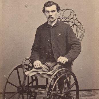 orporal Michael Dunn of Co. H, 46th Pennsylvania Infantry Regiment, after the amputation of his legs in 1864